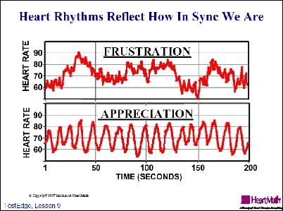 Heart Rhythms Figure